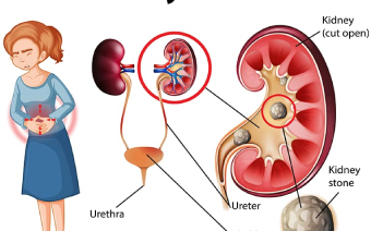 Chronic Disease Management